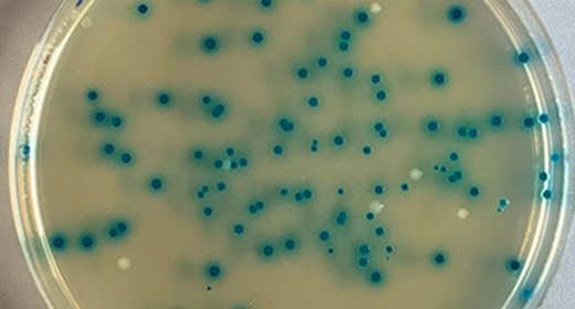 琼脂平板上的金门聚合阳性菌落